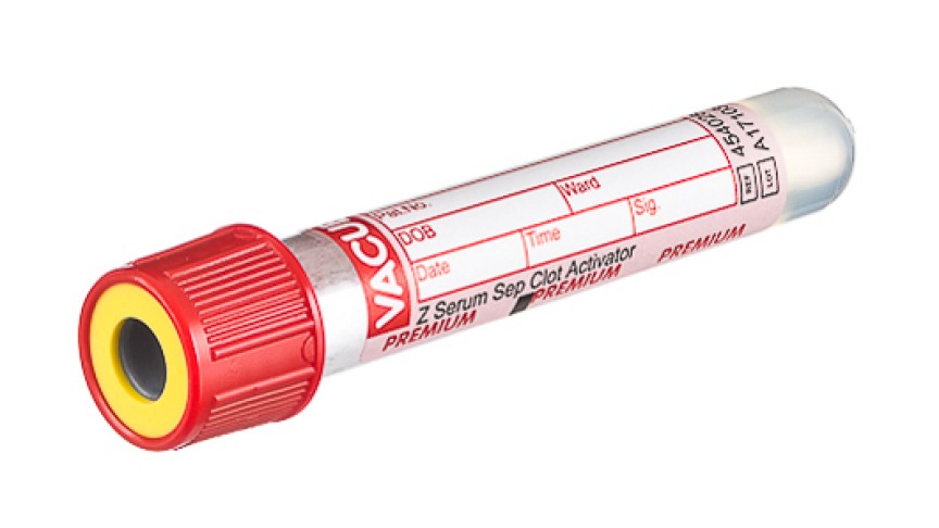 VACUETTE® TUBE 2.5 ml CAT Serum Separator Clot Activator
13x75 red cap-yellow ring, PREMIUM