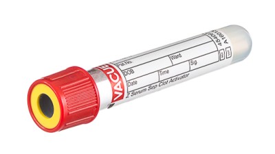 VACUETTE® TUBE 3.5 ml CAT Serum Separator Clot Activator
13x75 red cap-yellow ring, non-ridged