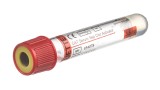 VACUETTE® TUBE 3.5 ml CAT Serum Separator Clot Activator
13x75 red cap-yellow ring, transparent label, non-ridged
