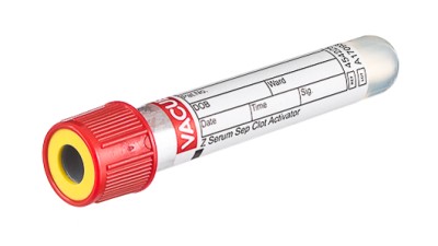 VACUETTE® TUBE 3.5 ml CAT Serum Separator Clot Activator
13x75 red cap-yellow ring, non-ridged