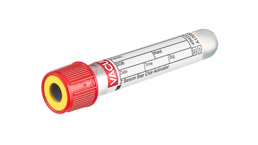 VACUETTE® TUBE 3.5 ml CAT Serum Separator Clot Activator
13x75 red cap-yellow ring, non-ridged