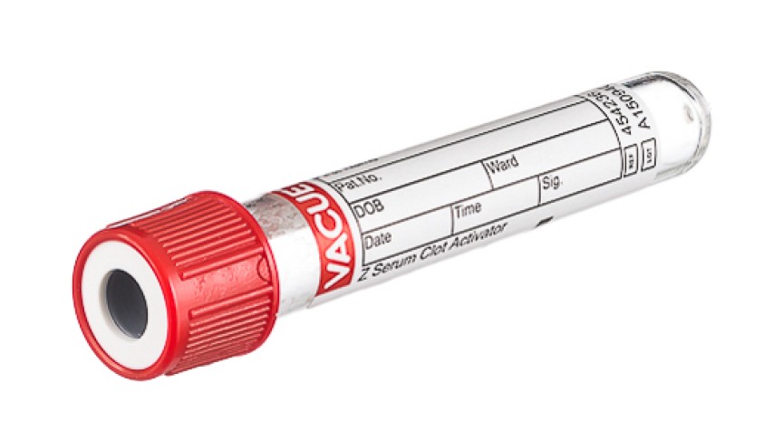 VACUETTE® TUBE 2 ml CAT Serum Clot Activator
13x75 red cap-white ring, non-ridged