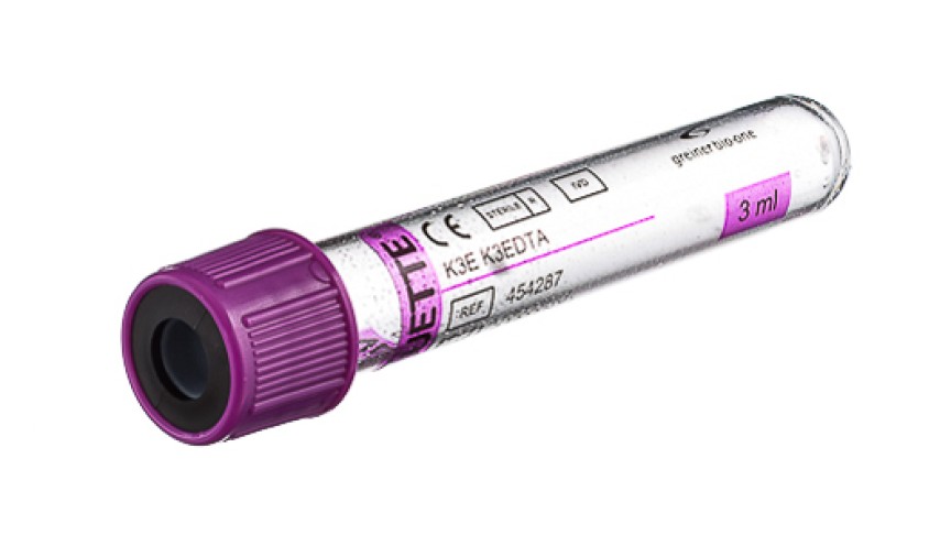VACUETTE® TUBE 3 ml K3E K3EDTA
13x75 lavender cap-black ring, transparent label, non-ridged