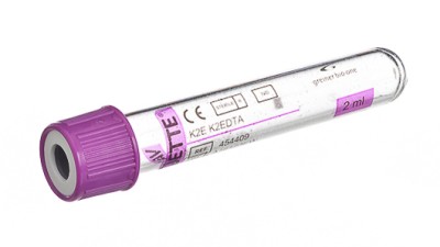 VACUETTE® TUBE 2 ml K2E K2EDTA
13x75 lavender cap-white ring, transparent label, non-ridged