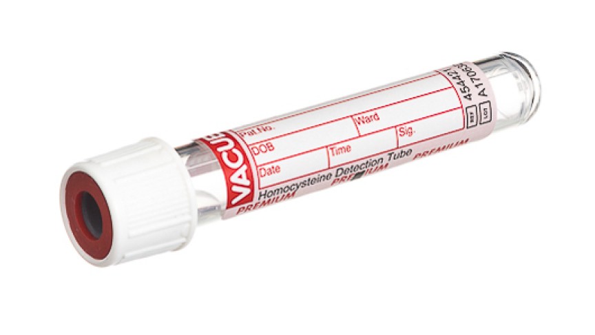 VACUETTE® TUBE 2 ml Homocysteine Detection
13x75 white cap-red ring, sandwich tube, PREMIUM