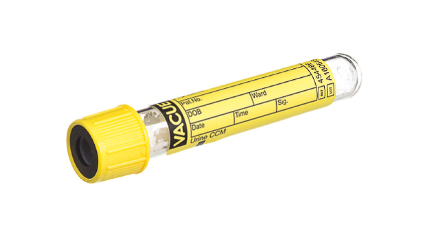 VACUETTE® TUBE 4 ml Urine CCM
13x75 yellow cap-black ring, Round Base, non-ridged