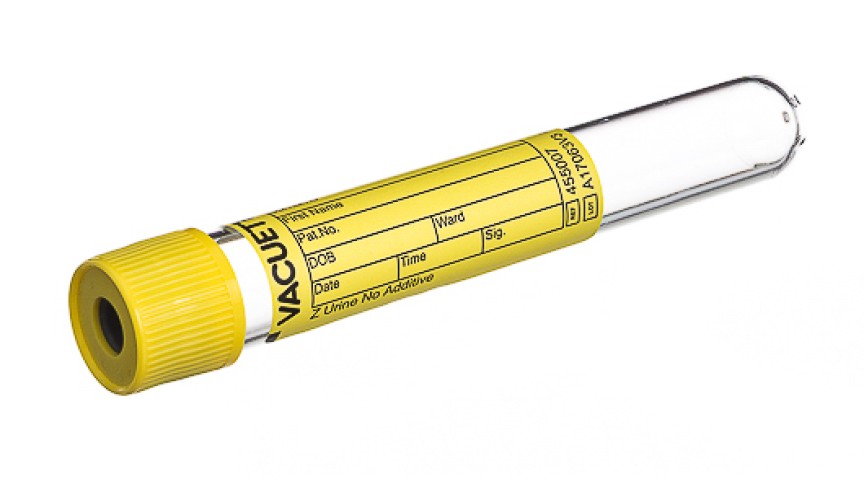 VACUETTE® TUBE 10 ml Z Urine No Additive
16x100 yellow cap-yellow ring, Round Base, non-ridged
