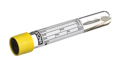 VACUETTE® TUBE 9 ml CPDA
16x100 yellow cap-black ring, non-ridged