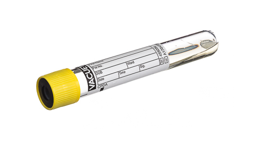 VACUETTE® TUBE 9 ml CPDA
16x100 yellow cap-black ring, non-ridged