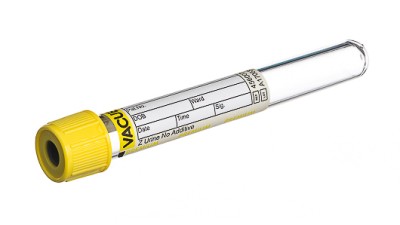 VACUETTE® TUBE 6 ml Z Urine No Additive
13x100 yellow cap-yellow ring, Round Base, PREMIUM