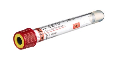 VACUETTE® TUBE 5 ml CAT Serum Separator Clot Activator
13x100 red cap-yellow ring, transparent label, non-ridged