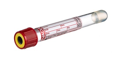 VACUETTE® TUBE 5 ml CAT Serum Separator Clot Activator
13x100 red cap-yellow ring, PREMIUM