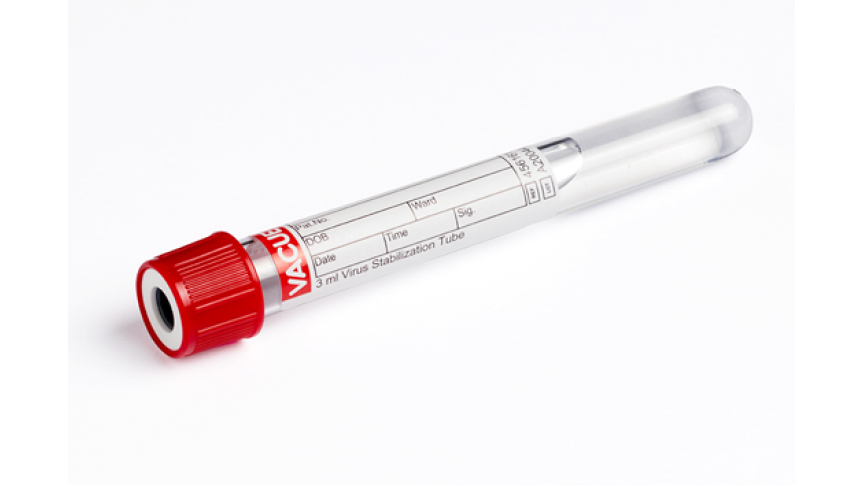 VACUETTE® 3 ml Virus Stabilization Tube
13x100 red cap-white ring, PREMIUM