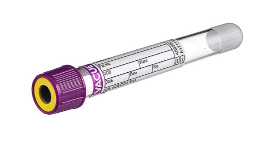 VACUETTE® TUBE 5 ml K2E K2EDTA Separator
13x100 lavender cap-yellow ring, non-ridged