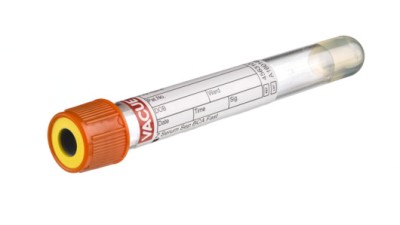 VACUETTE® TUBE 5 ml CAT Serum Fast Separator
13x100 orange cap-yellow ring, non-ridged