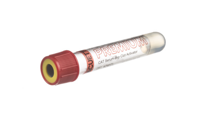 VACUETTE® TUBE 3.5 ml CAT Serum Separator Clot Activator
13x75 red cap-yellow ring, transparent label, PREMIUM