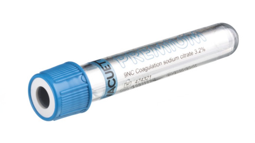 VACUETTE® TUBE 2 ml 9NC Coagulation sodium citrate 3.2%
13x75 blue cap-white ring, sandwich tube, transparent label, PREMIUM
