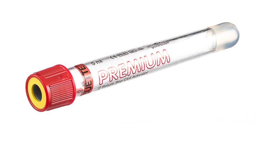 VACUETTE® TUBE 5 ml CAT Serum Separator Clot Activator
13x100 red cap-yellow ring, transparent label, PREMIUM