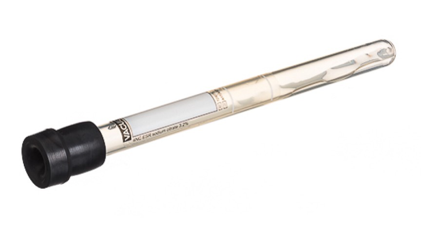VACUETTE® TUBE 1.5 ml 4NC ESR sodium citrate 3.2%
9x120 black cap, PP