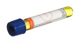 Greiner Bio-One Saliva Extraction Solution pH 4.2
13x75 royal blue cap-royal blue ring, non-ridged