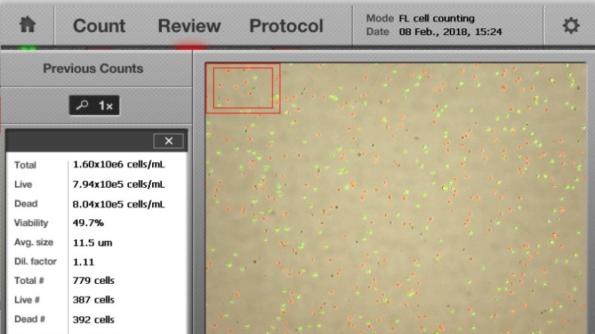 Automated Cell Counter