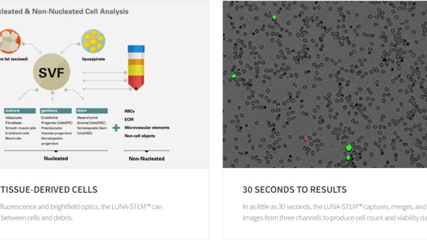 LUNA-STEM™ Automated Fluorescence Cell Counter for Stem Cells & SVF