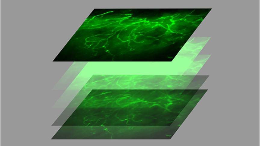 CELENA® S Digital Imaging System