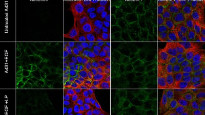 PSCs Differentiation