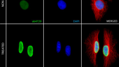 PSCs Differentiation